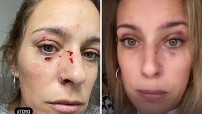 Dani La Chepi fue atacada por su gato.