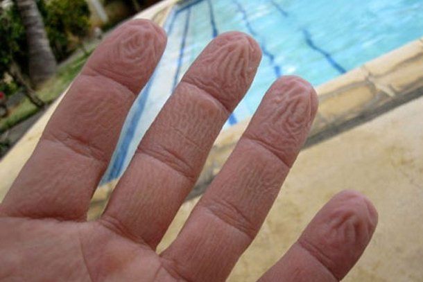 ¿Por qué se arrugan los dedos en el agua?