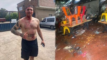 Brian Medina, líder de la Uocra, muestra sus heridas tras el enfrentamiento (Foto: Mauro Szeta).