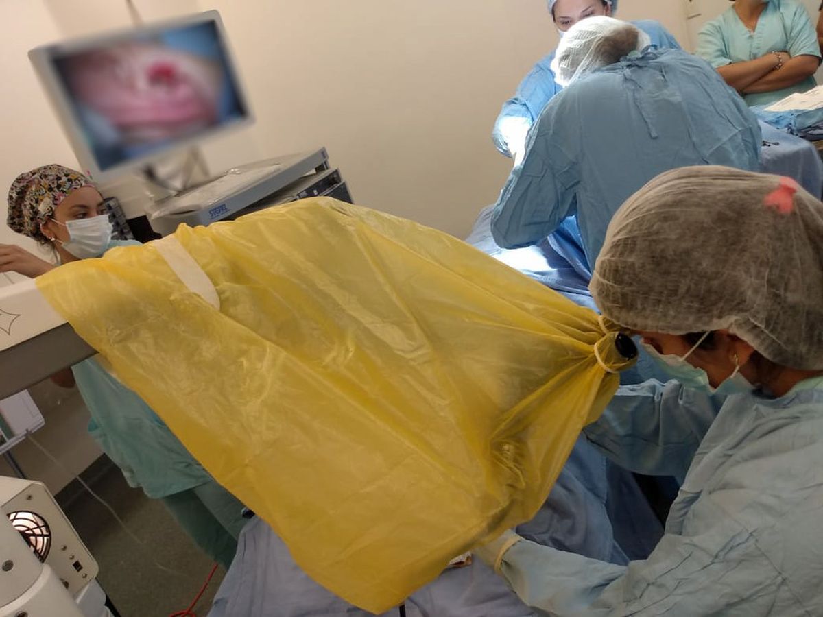 En el Hospital de Pocito se realizó la primera cirugía de timpanoplastia