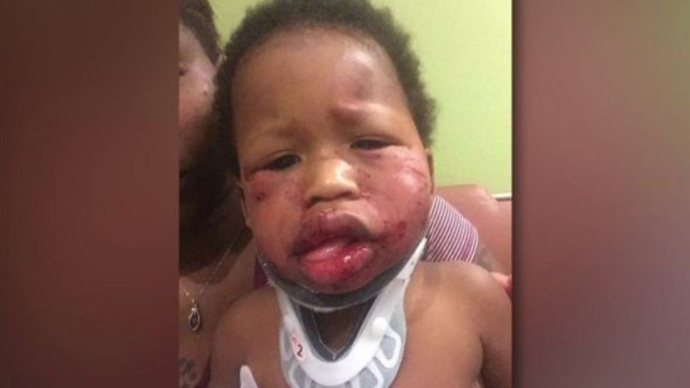 Indignante: una niñera le dio una brutal golpiza a un bebé en una guardería