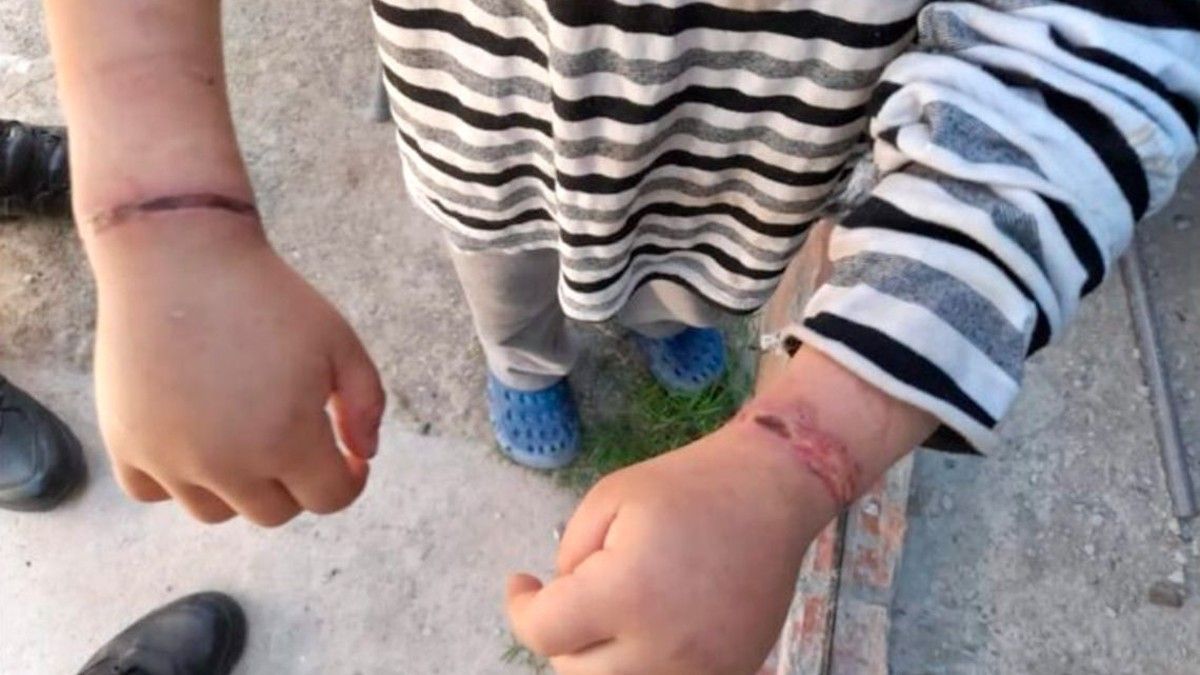 Un nene fue atado por su madre con alambres.