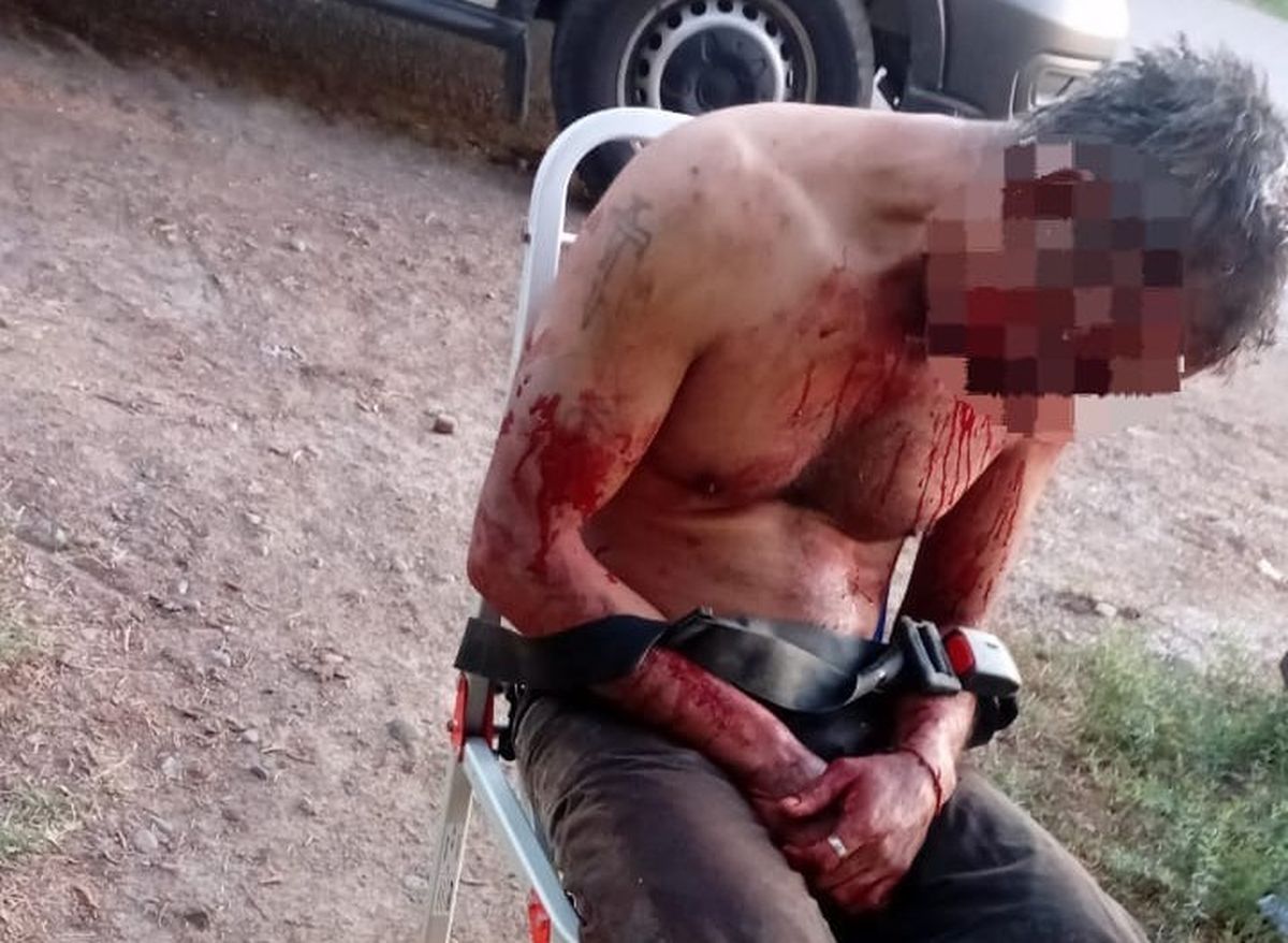 Un hombre fue acusado de atar a su tío y golpearlo con un palo luego de descubrir una infidelidad - Image 2