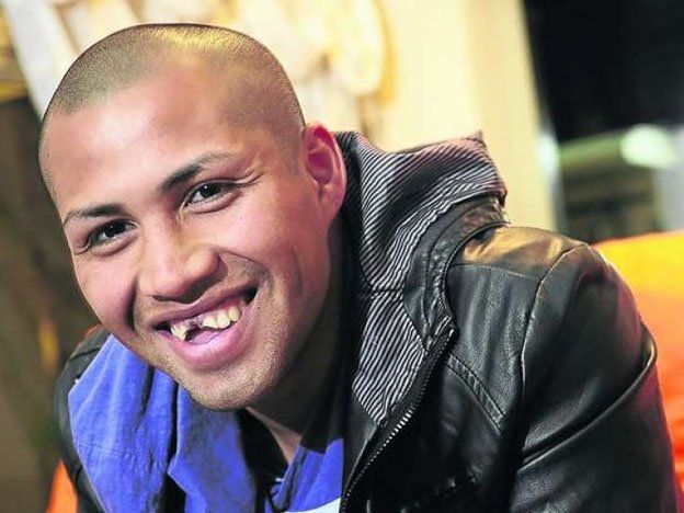 Esta es la nueva sonrisa del jugador de Argentinos que trabó con la cabeza