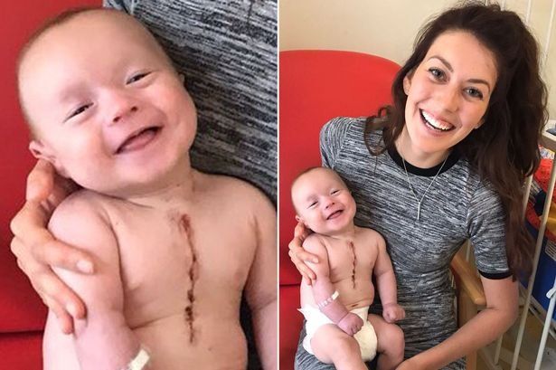 Mirá la sonrisa de este bebé tras ser sometido a una cirugía a corazón abierto