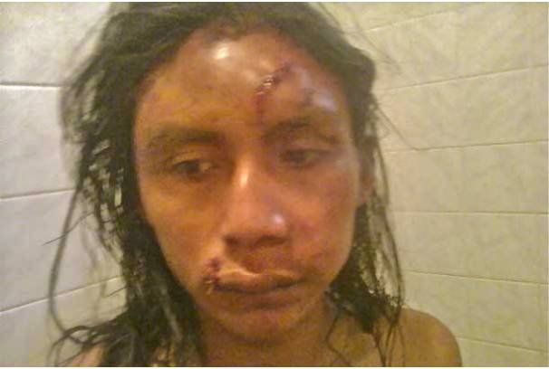 Formosa: brutal golpiza a dos jóvenes de la comunidad Qom, uno es hijo del cacique