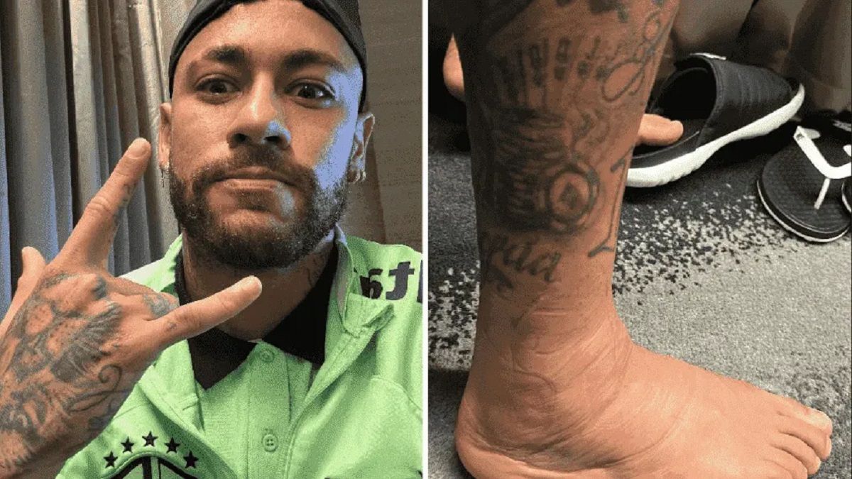 Neymar mostró cómo le quedó el tobillo tras la lesión