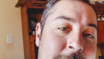 Fernando Arce manejaba su cuatriciclo cuando impactó contra un auto. 