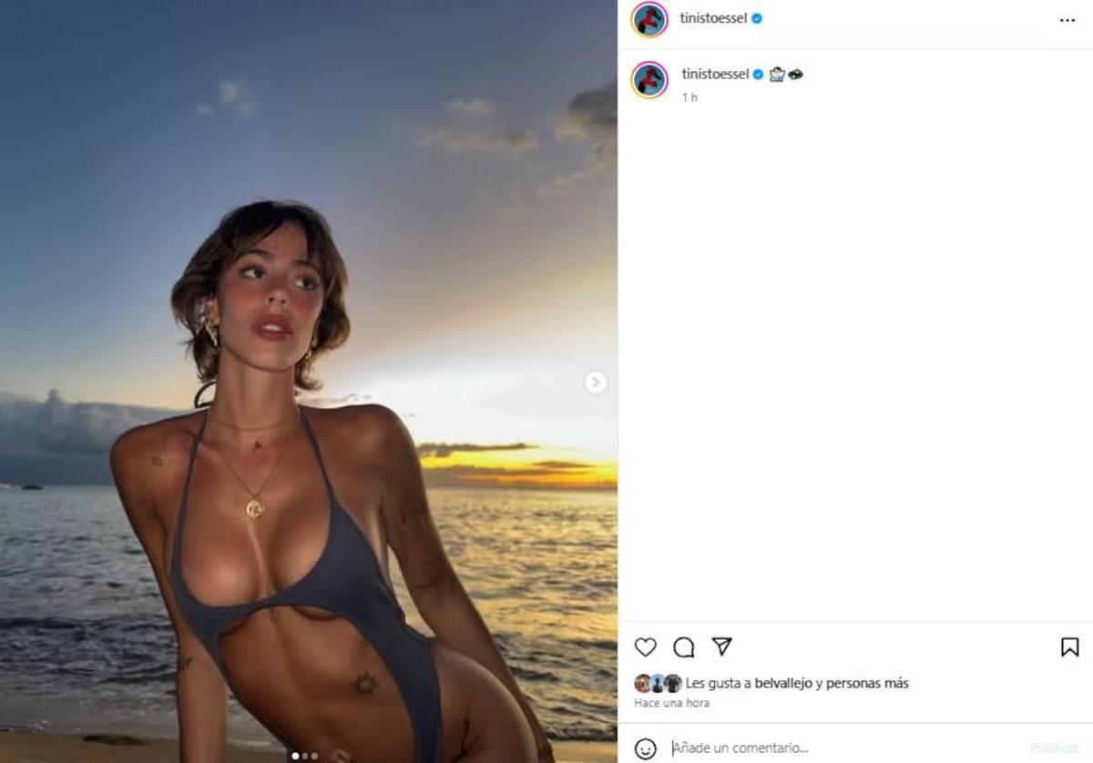 Tini Stoessel mostró el retoque estético que se hizo y se volvió tendencia en las redes